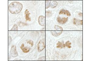 Immunohistochemistry (IHC) image for anti-Kinesin Family Member 2C (KIF2C) (AA 50-100) antibody (ABIN7448647) (KIF2C 抗体  (AA 50-100))