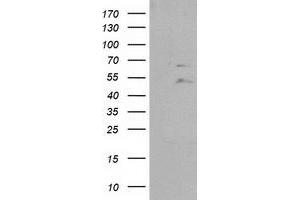 Western Blotting (WB) image for anti-Protein tyrosine Phosphatase, Non-Receptor Type 11 (PTPN11) antibody (ABIN1500499) (PTPN11 抗体)