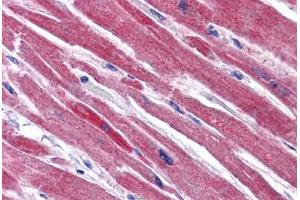 Human Heart: Formalin-Fixed, Paraffin-Embedded (FFPE) (RWDD3 抗体  (C-Term))