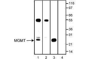 Image no. 2 for anti-O6-Methylguanine-DNA-Methyltransferase (MGMT) antibody (ABIN967567) (MGMT 抗体)