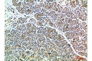 Immunohistochemical analysis of paraffin-embedded human-pancreas, antibody was diluted at 1:200 (MIA2 抗体  (AA 361-410))