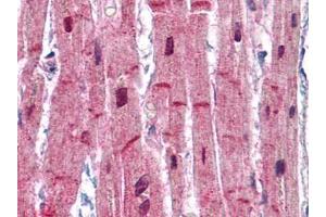Human Heart: Formalin-Fixed, Paraffin-Embedded (FFPE) (ACTN2 抗体)
