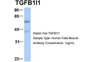 Host:  Rabbit  Target Name:  TGFB1I1  Sample Type:  Human Fetal Muscle  Antibody Dilution:  1. (TGFB1I1 抗体  (Middle Region))