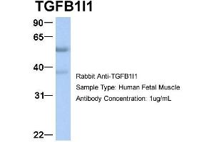 Host:  Rabbit  Target Name:  TGFB1I1  Sample Type:  Human Fetal Muscle  Antibody Dilution:  1.