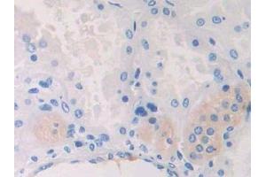 Detection of CAPN2 in Human Kidney Tissue using Polyclonal Antibody to Calpain 2 (CAPN2) (Calpain 2 抗体  (AA 45-514))