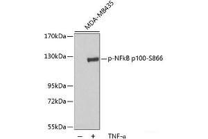 Western blot analysis of extracts of MDA-MB435 cells using Phospho-NFkB p100(S866) Polyclonal Antibody. (NFKB2 抗体  (pSer866))