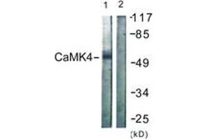 Western blot analysis of extracts from K562 cells, treated with H2O2 100uM 30', using CaMK4 (Ab-196/200) Antibody. (CAMK4 抗体  (AA 166-215))