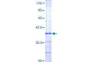 FBXO7 Protein (AA 357-455) (GST tag)