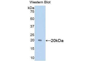 Western Blotting (WB) image for anti-Sex Hormone Binding Globulin (SHBG) (AA 222-358) antibody (ABIN1172841) (SHBG 抗体  (AA 222-358))