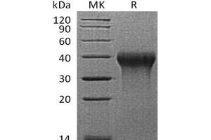 Western Blotting (WB) image for CD27 Molecule (CD27) protein (His tag) (ABIN7321004) (CD27 Protein (His tag))