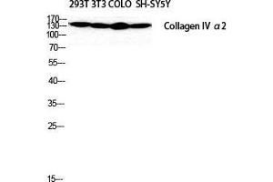 Western Blot (WB) analysis of SH-SY5Y 293T NIH-3T3 COLO205 cells using COL4A2 Polyclonal Antibody. (COL4a2 抗体  (N-Term))