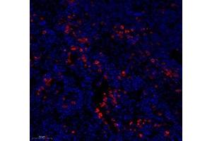 Immunofluorescence (Paraffin-embedded Sections) (IF (p)) image for anti-Membrane-Spanning 4-Domains, Subfamily A, Member 2 (Fc Fragment of IgE, High Affinity I, Receptor For, beta Polypeptide) (MS4A2) antibody (ABIN7074594)