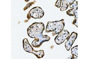 IHC analysis of MRE11 using anti-MRE11 antibody (ABIN7601056).