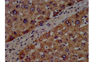 IHC image of ABIN7142850 diluted at 1:300 and staining in paraffin-embedded human liver tissue performed on a Leica BondTM system. (CYP8B1 抗体  (AA 303-440))