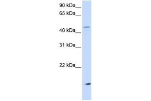 WB Suggested Anti-CETP Antibody Titration: 0. (CETP 抗体  (N-Term))