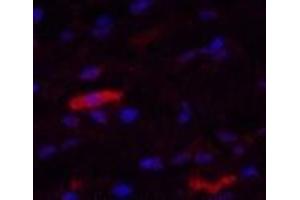 Immunofluorescence analysis of Human breast tissue using IDE Monoclonal Antibody at dilution of 1:200. (IDE 抗体)