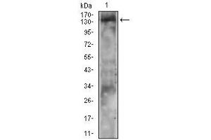 Western Blotting (WB) image for anti-Phospholipase C gamma 2 (PLCG2) (Tyr753) antibody (ABIN5864903) (Phospholipase C gamma 2 抗体  (Tyr753))