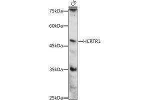 Western blot analysis of extracts of C6 cells, using HCRTR1 antibody (ABIN7267816) at 1:1000 dilution.