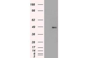 Western Blotting (WB) image for anti-Forkhead Box A1 (FOXA1) (AA 1-473) antibody (ABIN1490773) (FOXA1 抗体  (AA 1-473))
