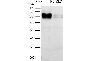 Western Blotting (WB) image for anti-Amyloid beta (A4) Precursor Protein-Binding, Family B, Member 1 (Fe65) (APBB1) antibody (ABIN7606802)