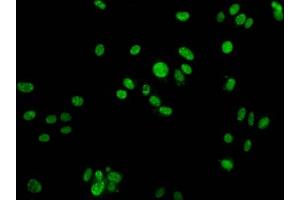 Immunofluorescence staining of HepG2 cells with ABIN7139631 at 1:25, counter-stained with DAPI. (H2AFX 抗体  (pTyr142))