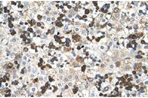 Immunohistochemical staining (Formalin-fixed paraffin-embedded sections) of human liver with HBZ polyclonal antibody  at 4-8 ug/mL working concentration. (HBZ 抗体  (N-Term))