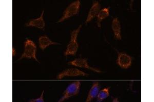 Immunofluorescence analysis of L929 cells using SCGN Polyclonal Antibody at dilution of 1:100. (SCGN 抗体)