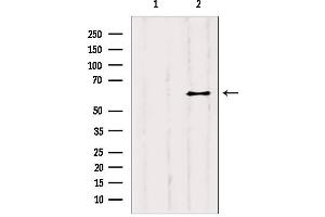 Western blot analysis of extracts from B6F10, using YTHDF2 antibody. (YTHDF2 抗体  (Internal Region))