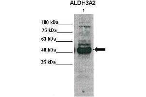 WB Suggested Anti-ALDH3A2 Antibody    Positive Control:  Lane1: 30ug human primary hepatocytes   Primary Antibody Dilution :   1:1000  Secondary Antibody :   Anti-rabbit-HRP   Secondry Antibody Dilution :   1:5000  Submitted by:  Takeshi Saito, USC Keck School of Medicine (ALDH3A2 抗体  (Middle Region))