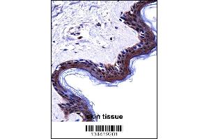 DSG1 Antibody immunohistochemistry analysis in formalin fixed and paraffin embedded human skin tissue followed by peroxidase conjugation of the secondary antibody and DAB staining. (Desmoglein 1 抗体  (AA 471-499))