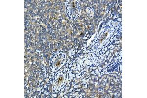 Immunohistochemistry of paraffin-embedded human tonsil using MMP9 Rabbit pAb (ABIN6134758, ABIN6143921, ABIN6143924 and ABIN6215080) at dilution of 1:100 (40x lens).