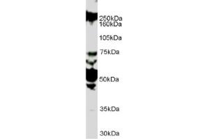 Image no. 1 for anti-Roundabout, Axon Guidance Receptor, Homolog 1 (ROBO1) (Internal Region) antibody (ABIN374636) (ROBO1 抗体  (Internal Region))