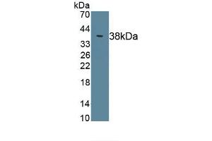 Detection of Recombinant C4, Rat using Polyclonal Antibody to Complement Component 4 (C4) (Complement C4 抗体  (AA 1419-1737))