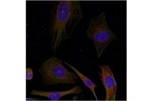 Image no. 3 for anti-Growth Associated Protein 43 (GAP43) (Ser41) antibody (ABIN197546) (GAP43 抗体  (Ser41))