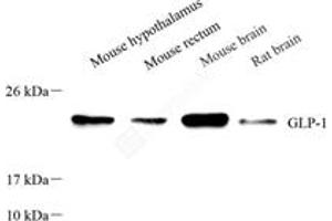 Western blot analysis of GLP1 (ABIN7074052),at dilution of 1: 800 (GLP-1 抗体)