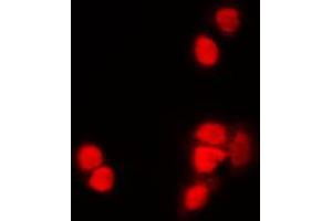 Immunofluorescent analysis of Histone H3 (AcK9) staining in NIH3T3 cells. (Histone 3 抗体  (H3K9ac))