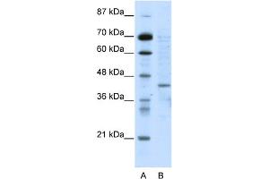 WB Suggested Anti-RING1 Antibody Titration:  5. (RING1 抗体  (N-Term))