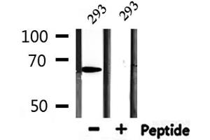 Western blot analysis of extracts from 293, using PIAS2 Antibody.