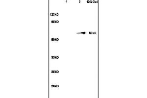 SDS-PAGE (SDS) image for anti-Sirtuin 1 (SIRT1) (AA 101-200) antibody (ABIN729853)