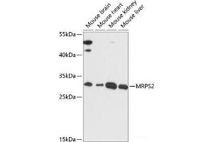 Western blot analysis of extracts of various cell lines using MRPS2 Polyclonal Antibody at dilution of 1:3000. (MRPS2 抗体)