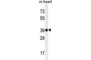 Western Blotting (WB) image for anti-Transmembrane BAX Inhibitor Motif Containing 4 (TMBIM4) (AA 1-30), (N-Term) antibody (ABIN955241)