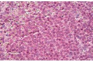Image no. 2 for anti-14-3-3 zeta (YWHAZ) (AA 200-245) antibody (ABIN1491173) (14-3-3 zeta 抗体  (AA 200-245))