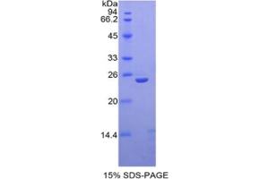 SDS-PAGE of Protein Standard from the Kit (Highly purified E. (Thrombospondin 1 ELISA 试剂盒)