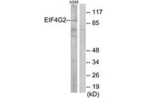 Western blot analysis of extracts from A549 cells, using EIF4G2 Antibody. (EIF4G2 抗体  (AA 41-90))
