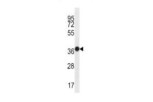 Western blot analysis in WiDr cell line lysates (35ug/lane). (MUC15 抗体  (C-Term))