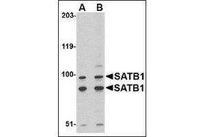 Western blot analysis of SATB1 in A20 cell lysate with this product at (A) 2 and (B) 4 μg/ml. (SATB1 抗体  (C-Term))
