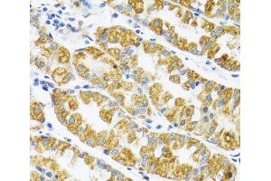 Immunohistochemistry of paraffin-embedded Human stomach using POLG2 Polyclonal Antibody at dilution of 1:100 (40x lens). (POLG2 抗体)
