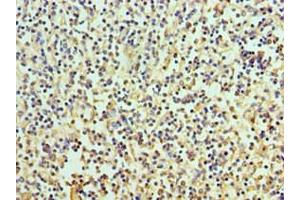 Immunohistochemistry of paraffin-embedded human spleen tissue using ABIN7167113 at dilution of 1:100 (RICTOR 抗体  (AA 1-245))