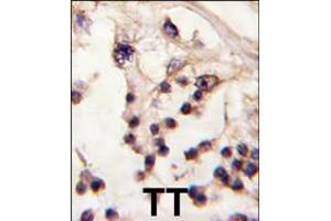 Formalin-fixed and paraffin-embedded human testis tissue reacted with TESK2 antibody , which was peroxidase-conjugated to the secondary antibody, followed by DAB staining.