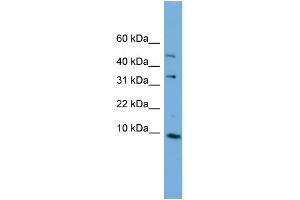 WB Suggested Anti-C16orf61 Antibody Titration: 0. (C16orf61 抗体  (Middle Region))